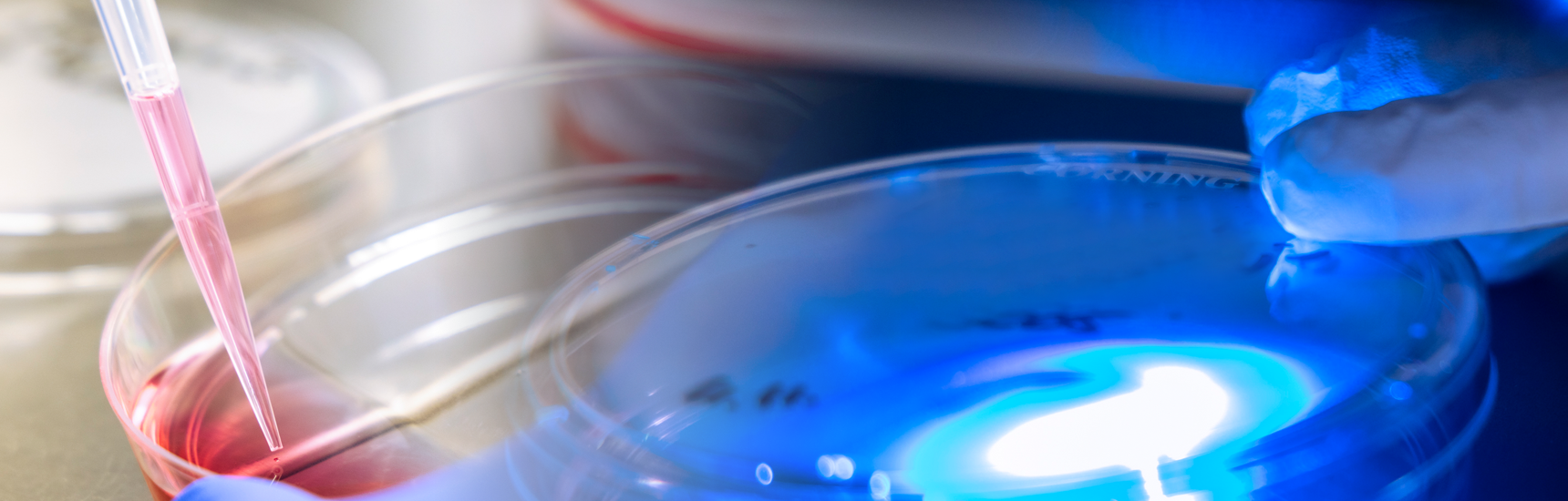 CD Labor Lungenkrebs